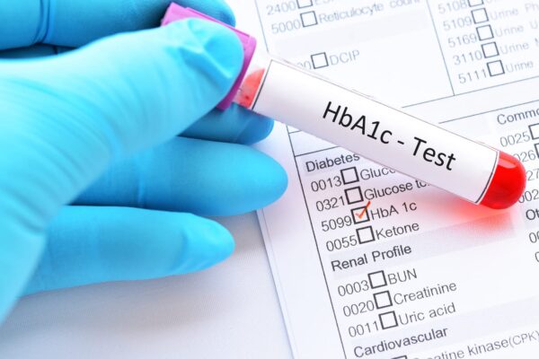 HBA1C-GLYCOSYLATED HB