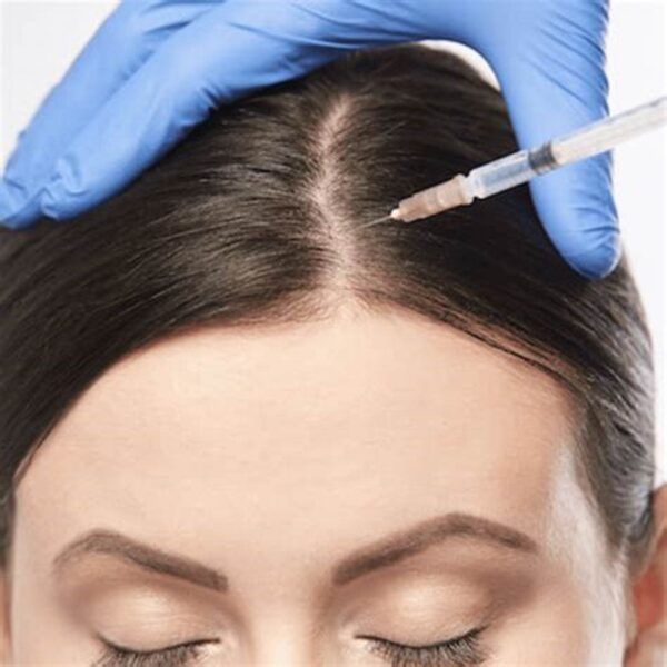 Mesotherapy hair regrowth